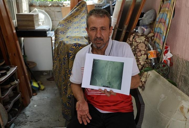Adana'da akılalmaz ihmal: Ameliyatta belinde "panç" unutuldu
