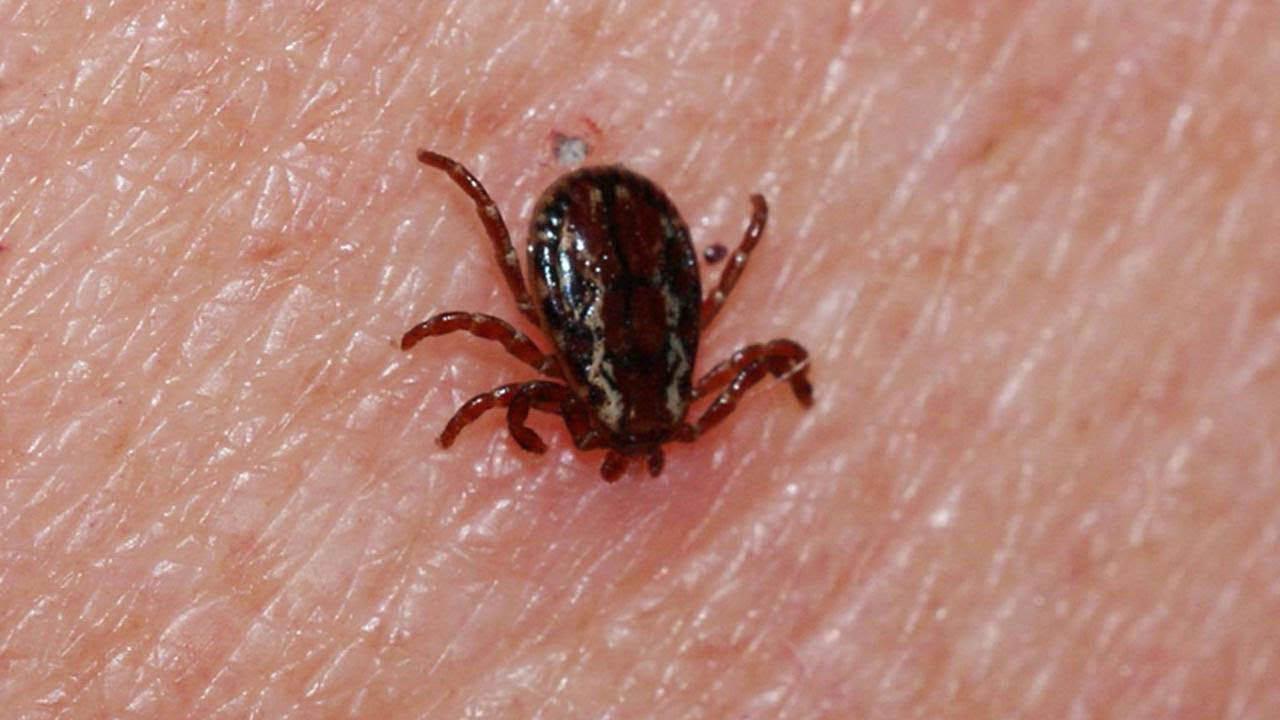 Hayati KKKA uyarısı: Kene müdahalesinde bunları yapmayın