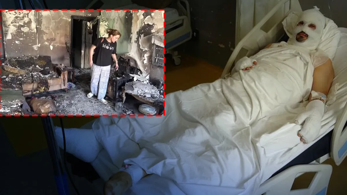 Hatay’da alevlerin arasında ailesini kurtarmak isterken ağır yaralandı: "Lamba ile telefon aynı anda patladı!”