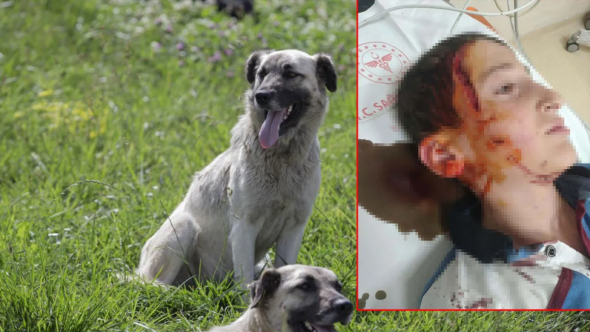 İzmir'deki köpek dehşetine ders gibi ceza: 11 yaşındaki çocuğun yüzünü parçalamıştı!