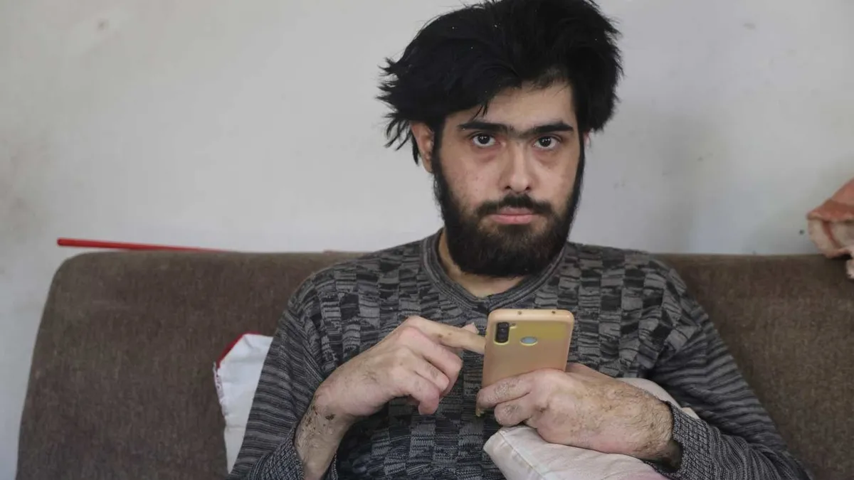 SON DAKİKA… Tüm Türkiye onu konuşmuştu! Telefon bağımlısı Barış Özbay’dan üzen haber geldi: Tedaviyi reddetti