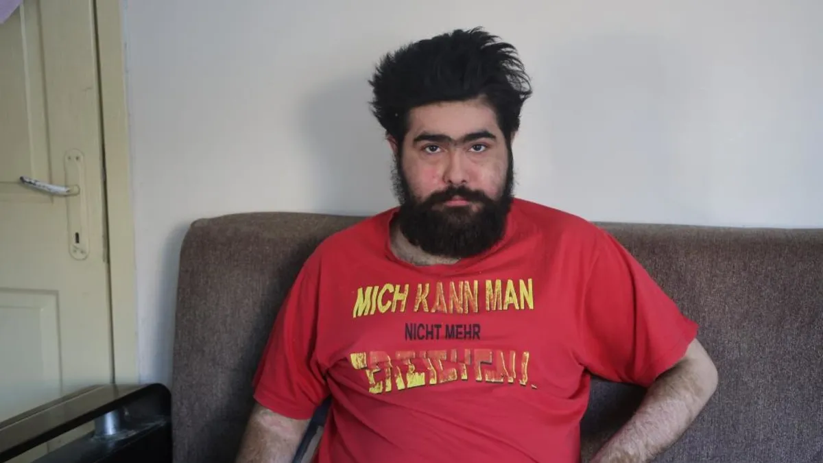 3 yıldır evden çıkmıyor... Sanal alem bağımlısı Barış'tan tişörtlü mesaj: "Ben artık iflah olmam"